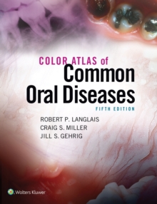 Color Atlas of Common Oral Diseases, Paperback / softback Book Color Atlas of Common Oral Diseases, Paperback / softback Book