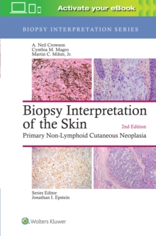 Biopsy Interpretation of the Skin : Primary Non-Lymphoid Cutaneous Neoplasia