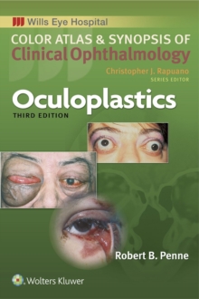 Oculoplastics