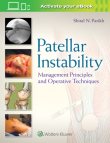 Patellar Instability : Management Principles and Operative Techniques