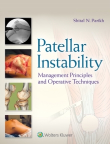 Patellar Instability : Management Principles and Operative Techniques