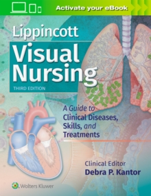 Lippincott Visual Nursing : A Guide to Clinical Diseases, Skills, and Treatments, Paperback Book Lippincott Visual Nursing : A Guide to Clinical Diseases, Skills, and Treatments, Paperback Book