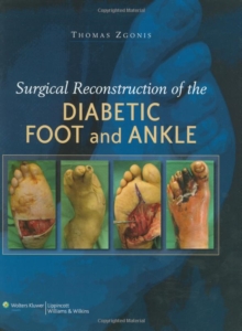 Surgical Reconstruction of the Diabetic Foot and Ankle