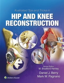 Illustrated Tips and Tricks in Hip and Knee Reconstructive and Replacement Surgery