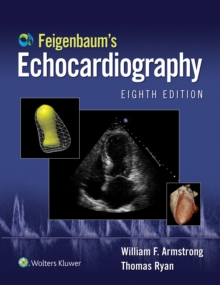 Feigenbaum's Echocardiography: Ebook without Multimedia