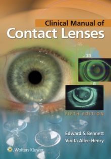 Clinical Manual of Contact Lenses