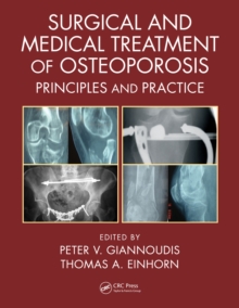 Surgical and Medical Treatment of Osteoporosis : Principles and Practice