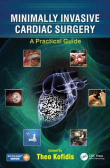 Minimally Invasive Cardiac Surgery : A Practical Guide