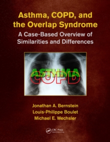 Asthma, COPD, and Overlap : A Case-Based Overview of Similarities and Differences, Paperback / softback Book Asthma, COPD, and Overlap : A Case-Based Overview of Similarities and Differences, Paperback / softback Book
