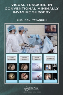 Visual Tracking in Conventional Minimally Invasive Surgery