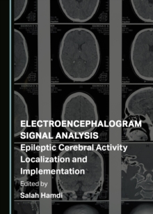 None Electroencephalogram Signal Analysis : Epileptic Cerebral Activity Localization and Implementation