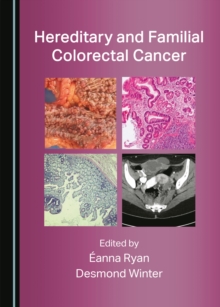 None Hereditary and Familial Colorectal Cancer