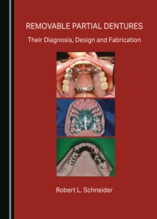 None Removable Partial Dentures : Their Diagnosis, Design and Fabrication