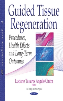 Guided Tissue Regeneration : Procedures, Health Effects & Long-Term Outcomes, Hardback Book Guided Tissue Regeneration : Procedures, Health Effects & Long-Term Outcomes, Hardback Book
