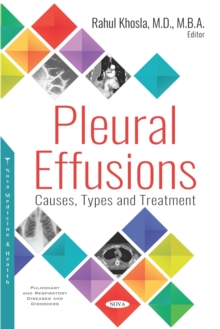 Pleural Effusions: Causes, Types and Treatment