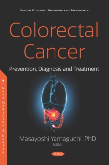 Colorectal Cancer: Prevention, Diagnosis and Treatment