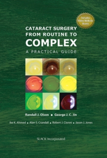 Cataract Surgery from Routine to Complex : A Practical Guide