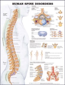 Human Spine Disorders Anatomical Chart|Oksana Zabuzhko|Paperback / softback