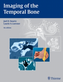 Imaging of the Temporal Bone, Hardback Book Imaging of the Temporal Bone, Hardback Book
