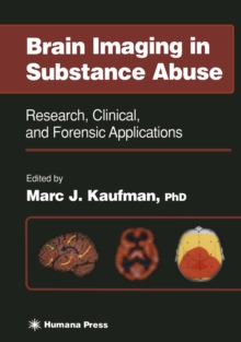 Brain Imaging in Substance Abuse : Research, Clinical, and Forensic Applications