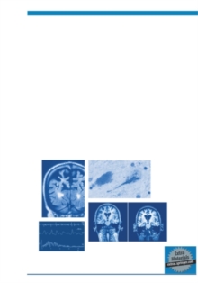 Atypical Parkinsonian Disorders : Clinical and Research Aspects