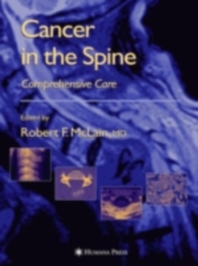 Cancer in the Spine : Comprehensive Care