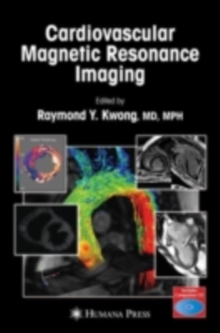 Cardiovascular Magnetic Resonance Imaging