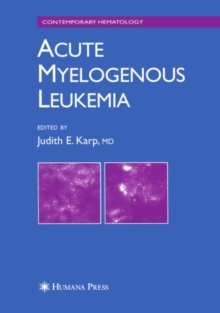 Acute Myelogenous Leukemia