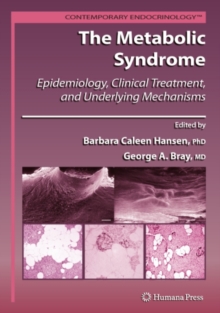 The Metabolic Syndrome: : Epidemiology, Clinical Treatment, and Underlying Mechanisms