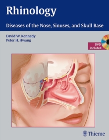 Rhinology : Diseases of the Nose, Sinuses, and Skull Base, Hardback Book Rhinology : Diseases of the Nose, Sinuses, and Skull Base, Hardback Book