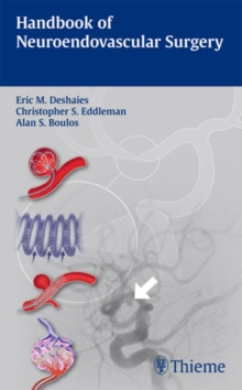 Handbook of Neuroendovascular Surgery, Paperback Book Handbook of Neuroendovascular Surgery, Paperback Book