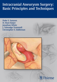 Intracranial Aneurysm Surgery : Basic Principles and Techniques, Paperback Book Intracranial Aneurysm Surgery : Basic Principles and Techniques, Paperback Book