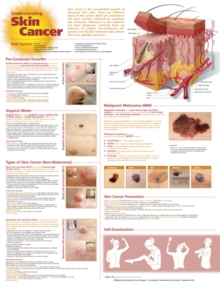 Understanding Skin Cancer Anatomical Chart, Wallchart Book Understanding Skin Cancer Anatomical Chart, Wallchart Book