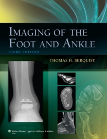 Imaging of the Foot and Ankle, Hardback Book Imaging of the Foot and Ankle, Hardback Book