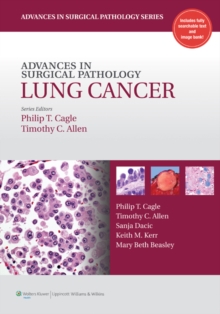 Advances in Surgical Pathology: Lung Cancer, Hardback Book Advances in Surgical Pathology: Lung Cancer, Hardback Book