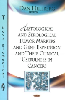Histological & Serological Tumour Markers & Gene Expression & Their Clinical Usefulness in Cancers, Hardback Book Histological & Serological Tumour Markers & Gene Expression & Their Clinical Usefulness in Cancers, Hardback Book
