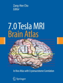 7.0 Tesla MRI Brain Atlas : In Vivo Atlas with Cryomacrotome Correlation