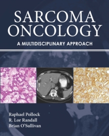 Sarcoma Oncology : A Multidisciplinary Approach