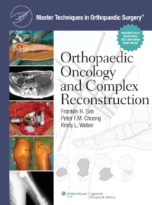 Master Techniques in Orthopaedic Surgery: Orthopaedic Oncology and Complex Reconstruction, Hardback Book Master Techniques in Orthopaedic Surgery: Orthopaedic Oncology and Complex Reconstruction, Hardback Book