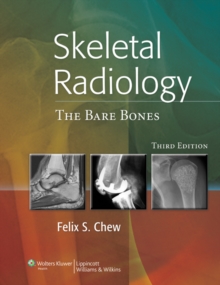Skeletal Radiology : The Bare Bones, Hardback Book Skeletal Radiology : The Bare Bones, Hardback Book