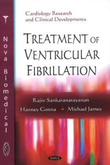 Treatment of Ventricular Fibrillation, Paperback Book Treatment of Ventricular Fibrillation, Paperback Book
