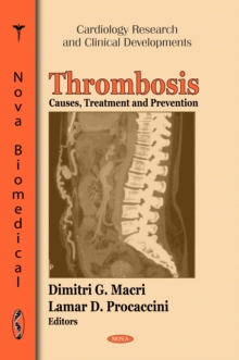 Thrombosis : Causes, Treatment and Prevention