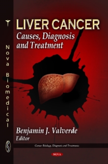Liver Cancer : Causes, Diagnosis & Treatment, Hardback Book Liver Cancer : Causes, Diagnosis & Treatment, Hardback Book