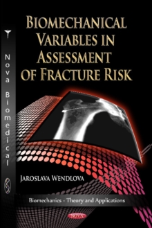 Biomechanical Variables in Assessment of Fracture Risk, Paperback Book Biomechanical Variables in Assessment of Fracture Risk, Paperback Book
