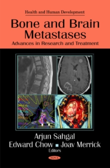 Bone & Brain Metastases : Advances in Research & Treatment, Hardback Book Bone & Brain Metastases : Advances in Research & Treatment, Hardback Book