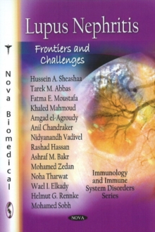 Lupus Nephritis : Frontiers & Challenges, Paperback Book Lupus Nephritis : Frontiers & Challenges, Paperback Book
