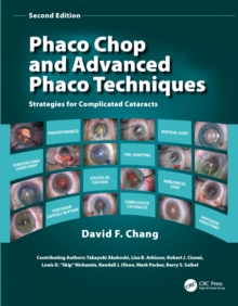 Phaco Chop and Advanced Phaco Techniques : Strategies for Complicated Cataracts, Mixed media product Book Phaco Chop and Advanced Phaco Techniques : Strategies for Complicated Cataracts, Mixed media product Book