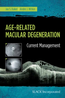 Age-Related Macular Degeneration : Current Management