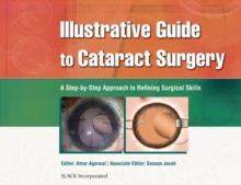 Illustrative Guide to Cataract Surgery : A Step-by-Step Approach to Refining Surgical Skills