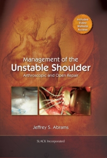 Management of the Unstable Shoulder : Arthroscopic and Open Repair